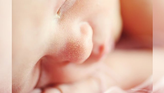 Delhi doctors implant permanent pacemaker in newborn baby’s heart