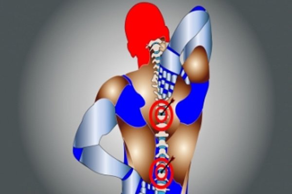 Facing back pain? You could be suffering from Ankylosing Spondylitis