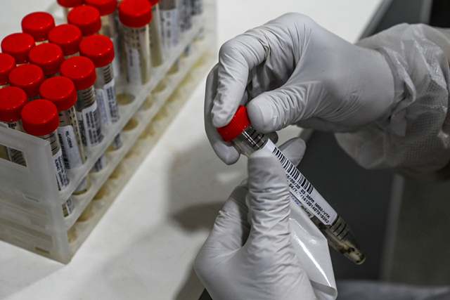 COVID-19: Active cases remain below 7.5-lakh mark