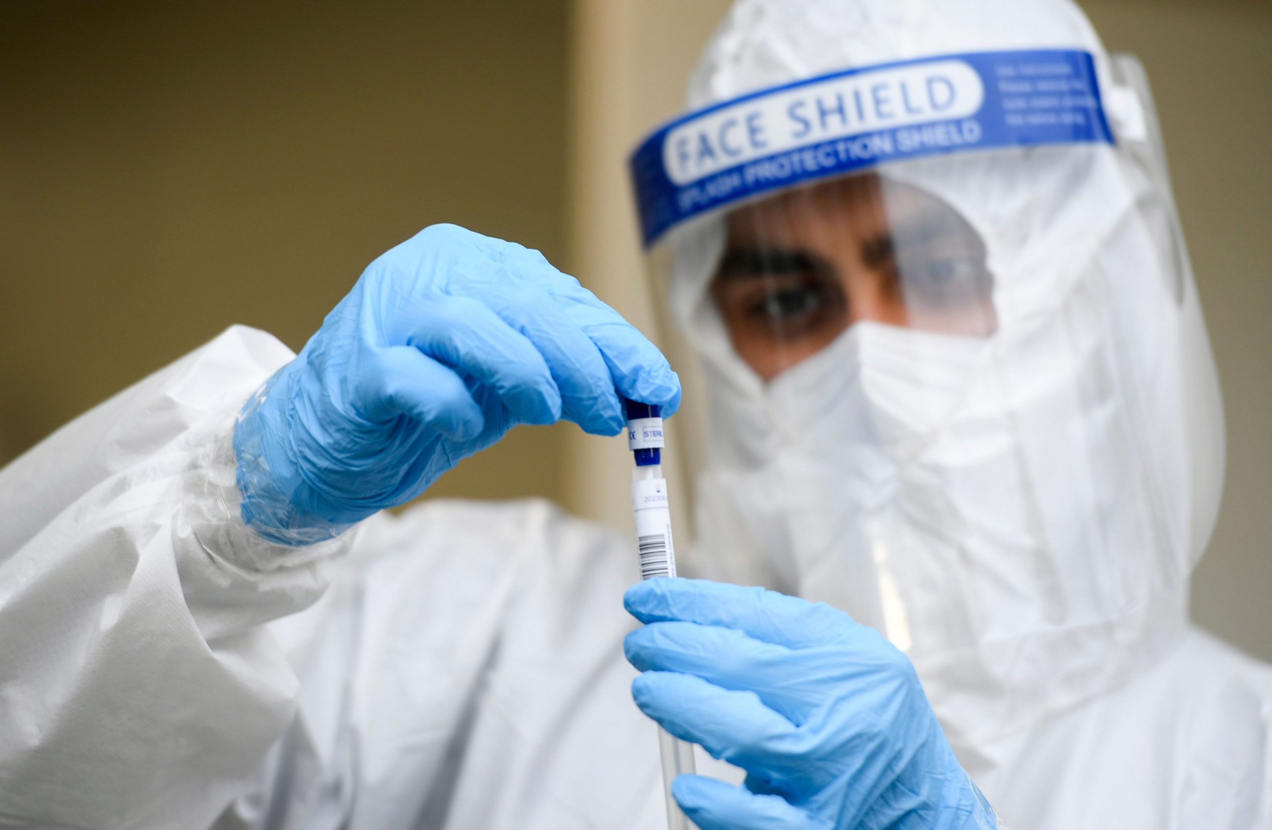 Global Covid-19 cases top 38.8 mn: Johns Hopkins