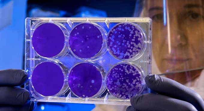 Eating turkey, probiotics may treat people with celiac disease