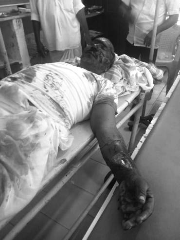 Farmer injured in sloth bear attack in Medak