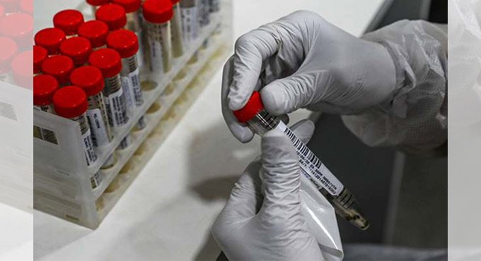 Blacks, Asians at larger risk of contracting Covid-19: UK study