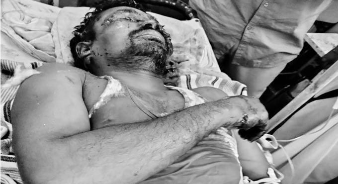 Adilabad: Farmer injured in bear attack