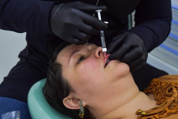 Plastic surgery