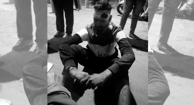 One killed, one injured in bike accident in Hyderabad