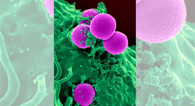 Bacteria can travel from one continent to another