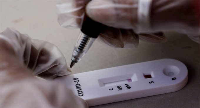 Covid-19-antibody-test