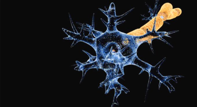 No link between Covid, Guillain-Barre syndrome: Study