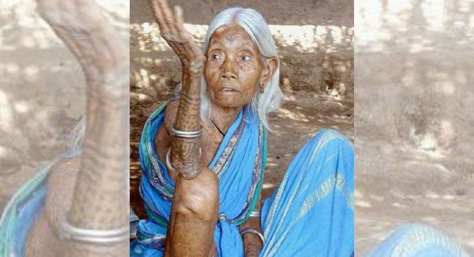 Tribal woman who helped Haimendorf passes away in Asifabad