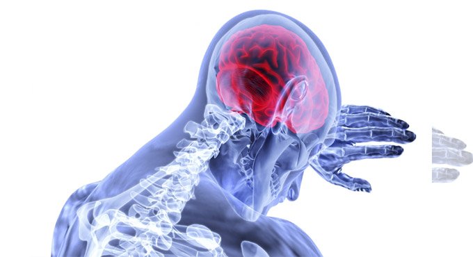 ‘Stroke, altered mental state increase death risk for Covid patients’