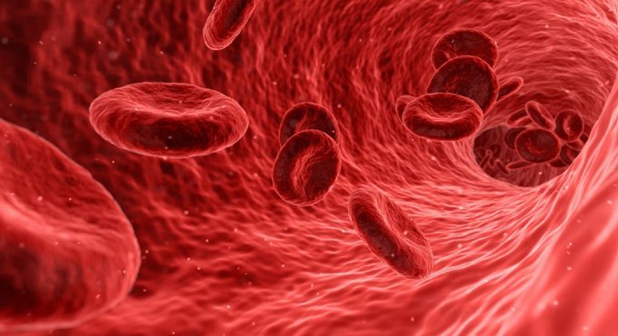 People with severe Covid, secondary blood infections may have worse health outcomes