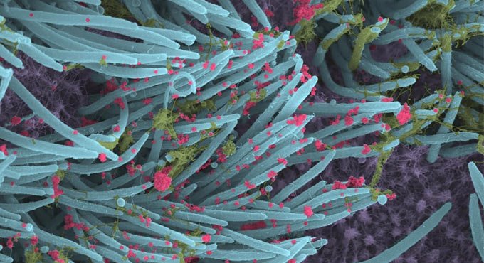 Novel method may help detect Covid antibodies in seconds