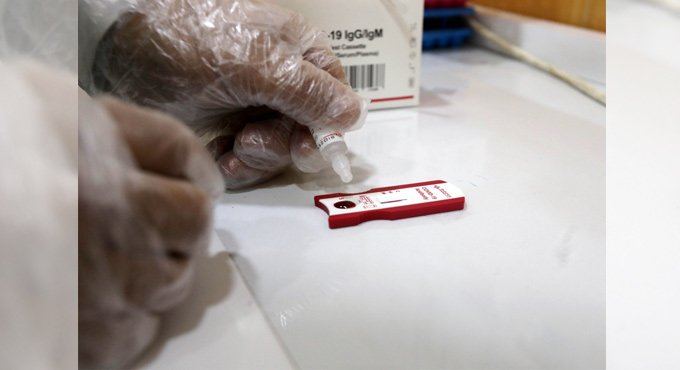 Rapid blood test to detect severe disease risk of Covid patients