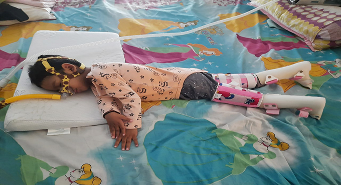 Hyderabad: Parents take to crowd funding for son’s rare disease