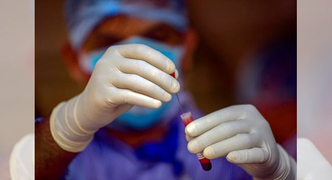 One in four in Telangana has antibodies against SARS-CoV-2: NIN study