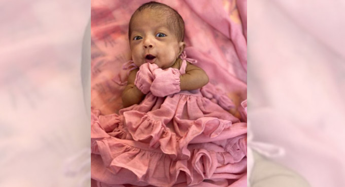 Hyderabad: Premature baby gets a new lease of life