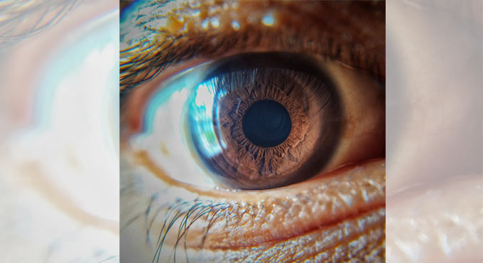 Retinal damage may signal risk of stroke, dementia