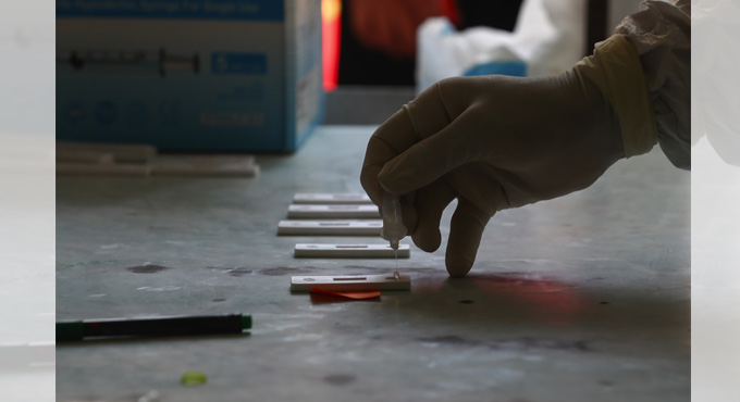 COVID-19: 2055 new infections and 7 deaths in Telangana