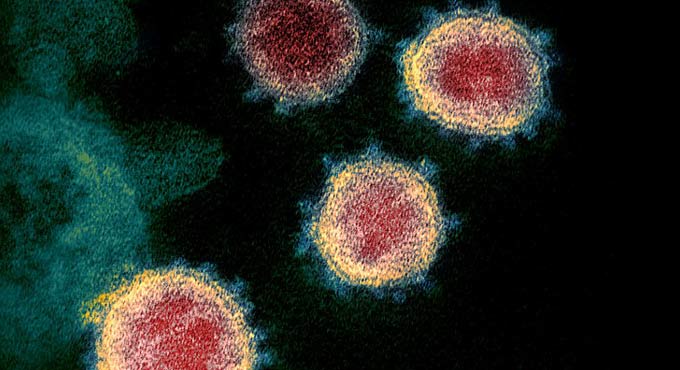 Nanobody neutralization of SARS-CoV-2 and variant