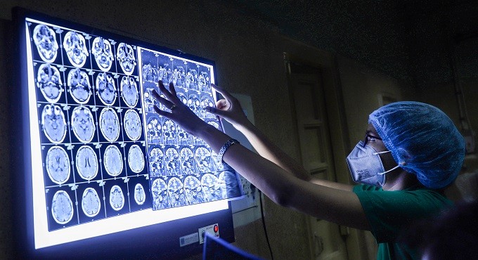 Experts link black fungus to zinc supplements