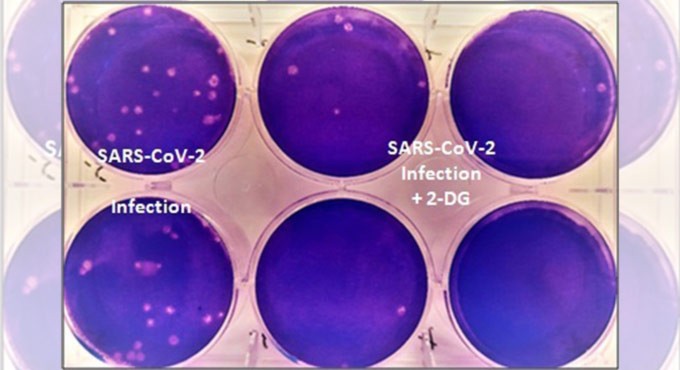 DCGI approves anti-COVID drug developed by DRDO for emergency use