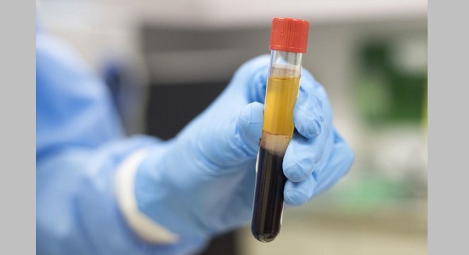 Plasma therapy dropped from Covid management guidelines