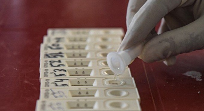 Lab technician held in Hyderabad for fake Covid report