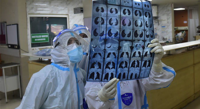 ‘Avoid CT scan for Covid diagnosis’