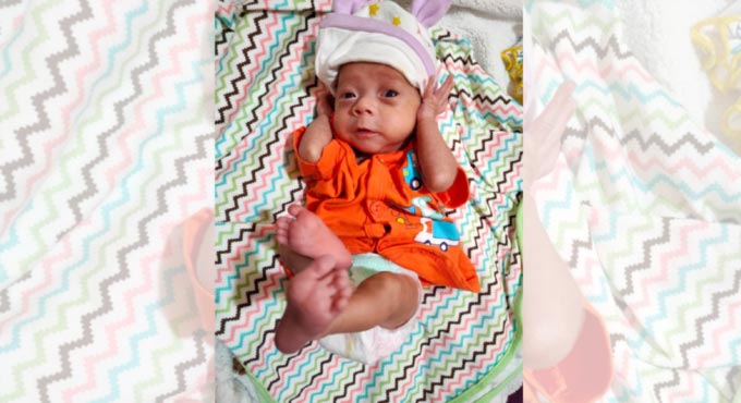 Surgeons at KIMS Cuddles save preterm baby with congenital heart defect