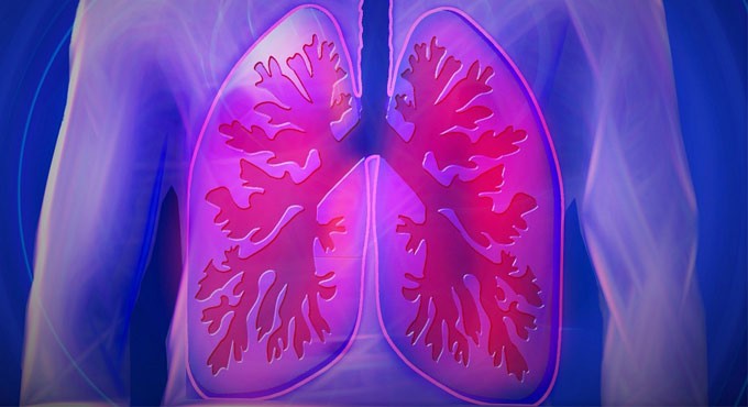 Radiotracer effective for detection and assessment of lung fibrosis
