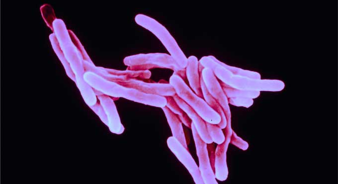 Studies throw light on how TB destroys lungs and how to protect them