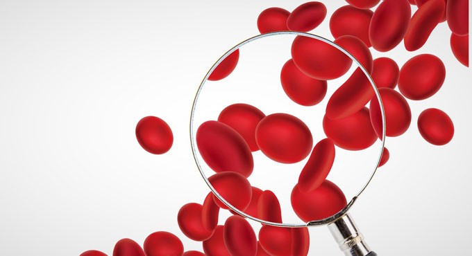 Increasing iron intake alone will not reduce anemia: NIN study