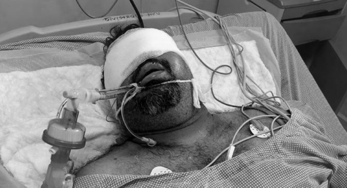 AP sanctions Rs 17 lakhs for treatment of Kathi Mahesh