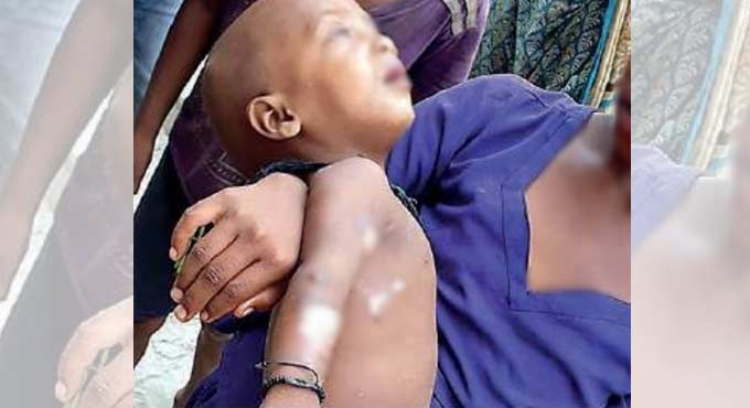 Child gets burn injuries as cop kicks at pressure cooker in Lucknow