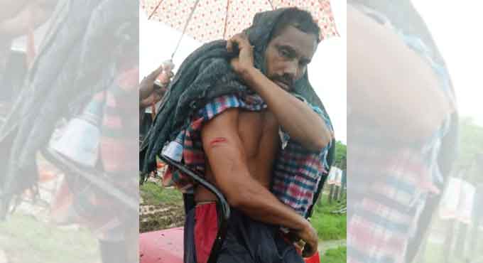 Man injured in bear attack in Bhupalpally district