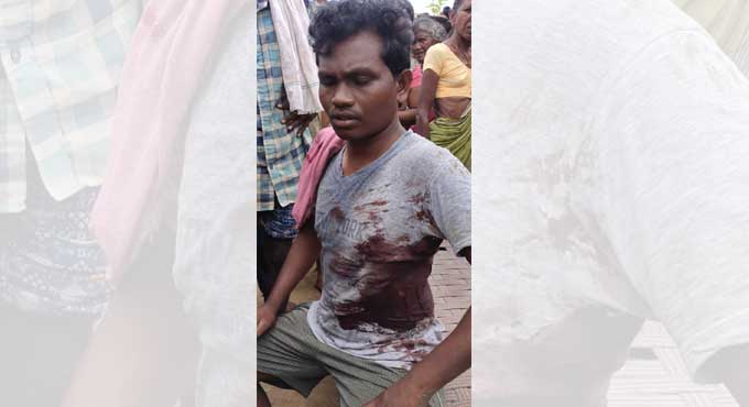 Youth escapes with broken ribs in bear attack in Asifabad