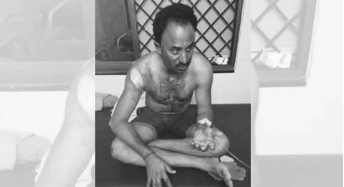 Telangana: Sarpanch pours petrol on technical assistant, sets him on fire