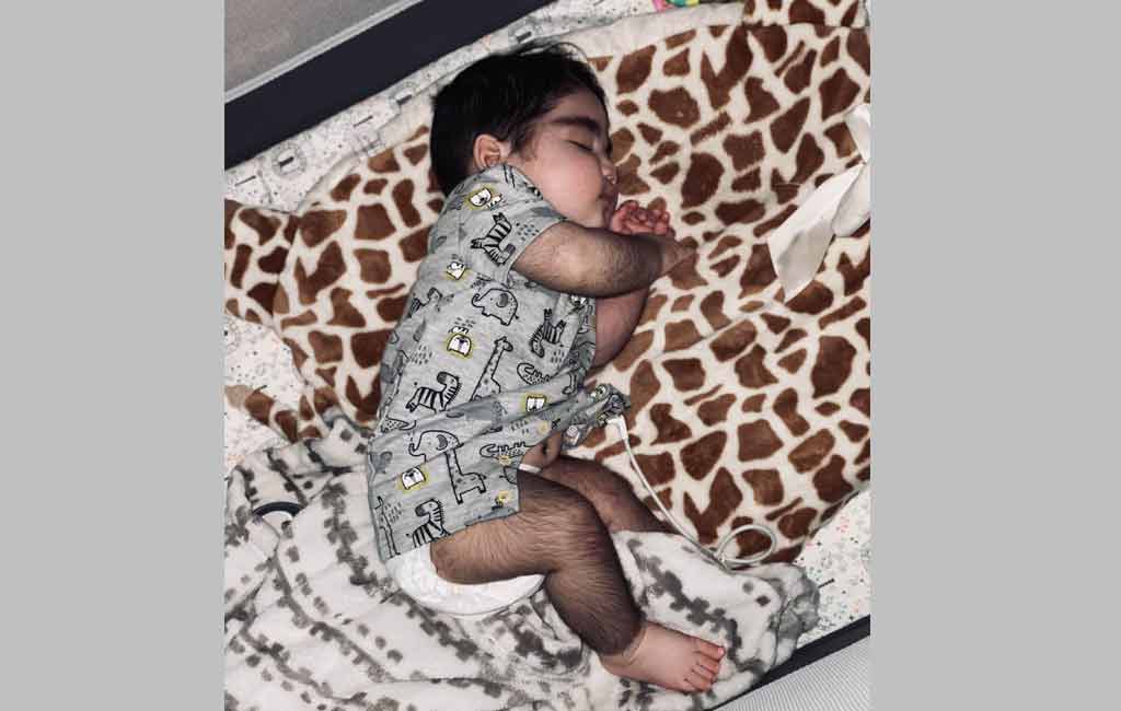 This baby in US has hair growing all over his body; is called ‘baby gorilla’