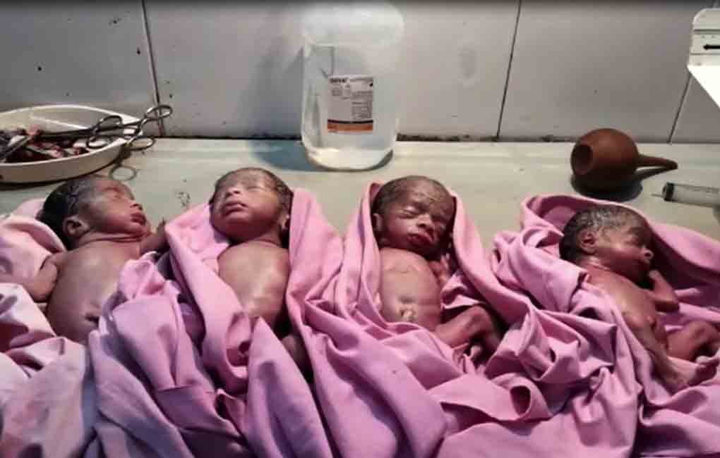 Karimnagar woman gives birth to quadruplets, months after twin sister delivers triplets
