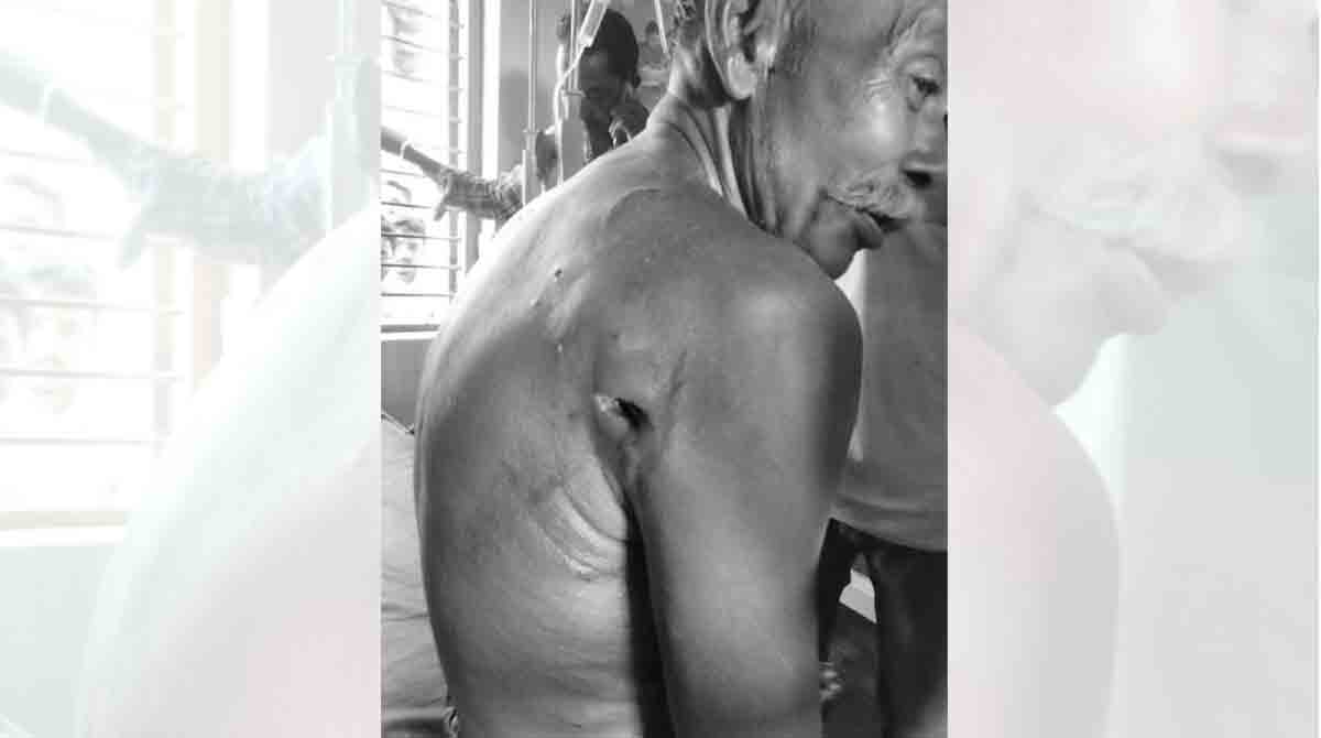 Shepherd injured in tiger attack in Mancherial