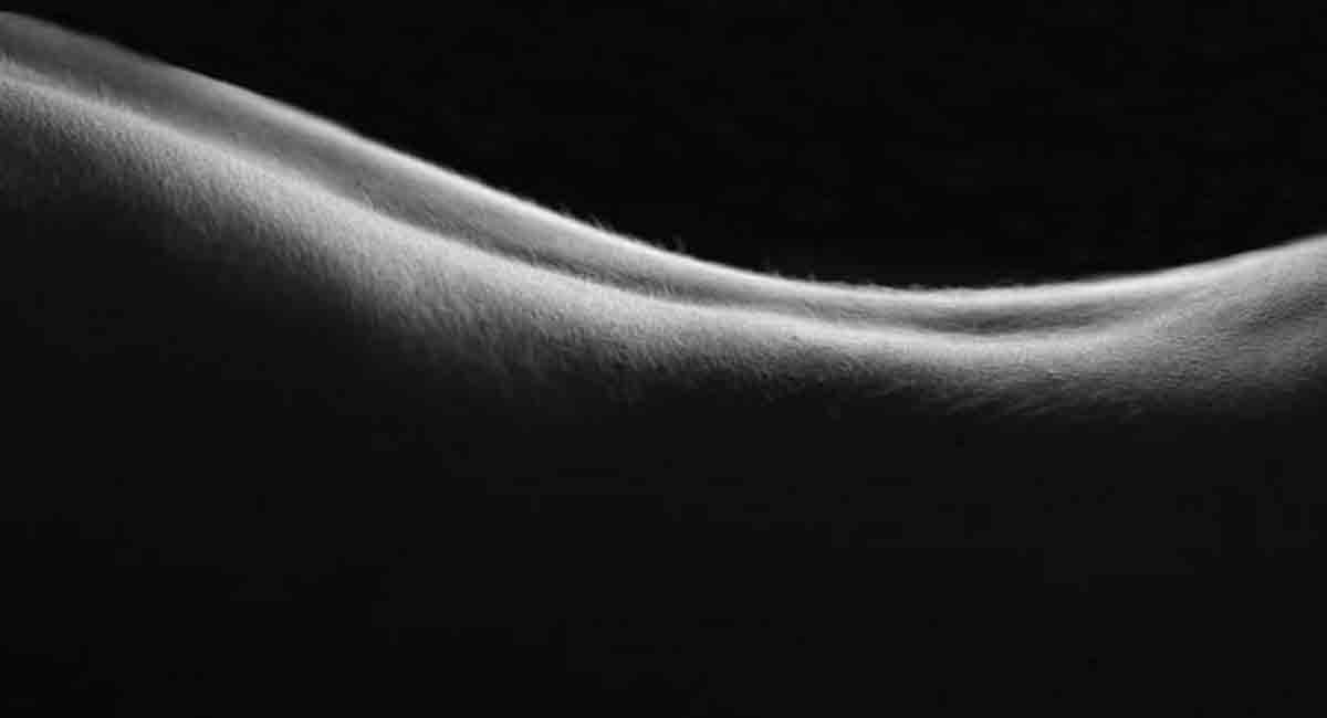 4 ways psoriasis can worsen if not managed well