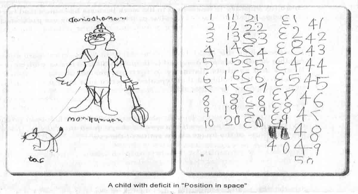 Understanding a child’s learning disabilities