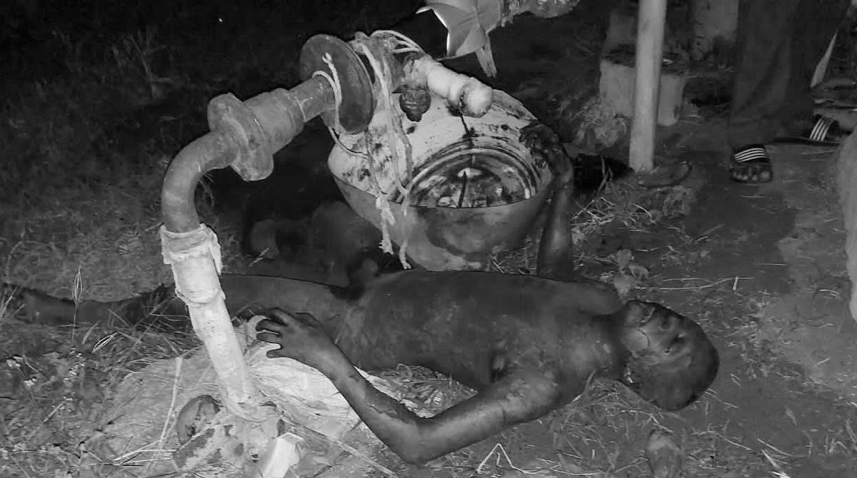 Man with burn injuries found in Medak