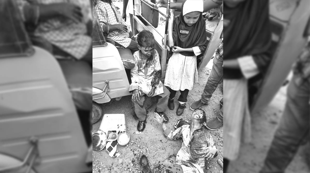 School students hurt as auto overturns in Sangareddy