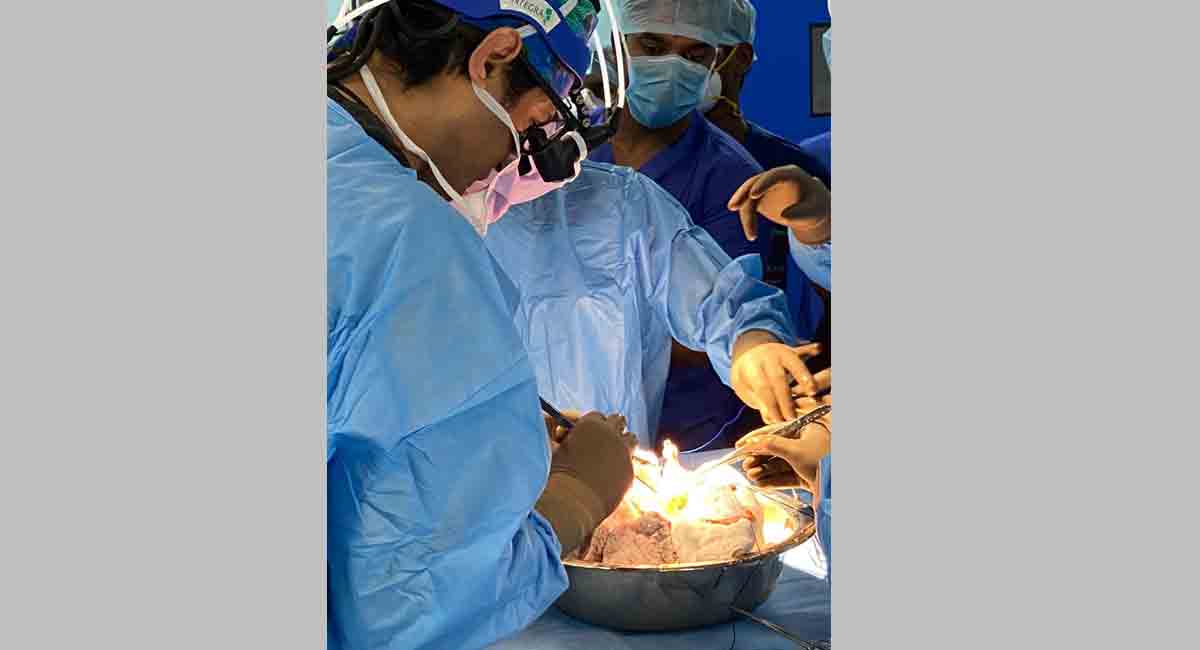 Hyderabad: Doctors at KIMS perform breathing lung transplant