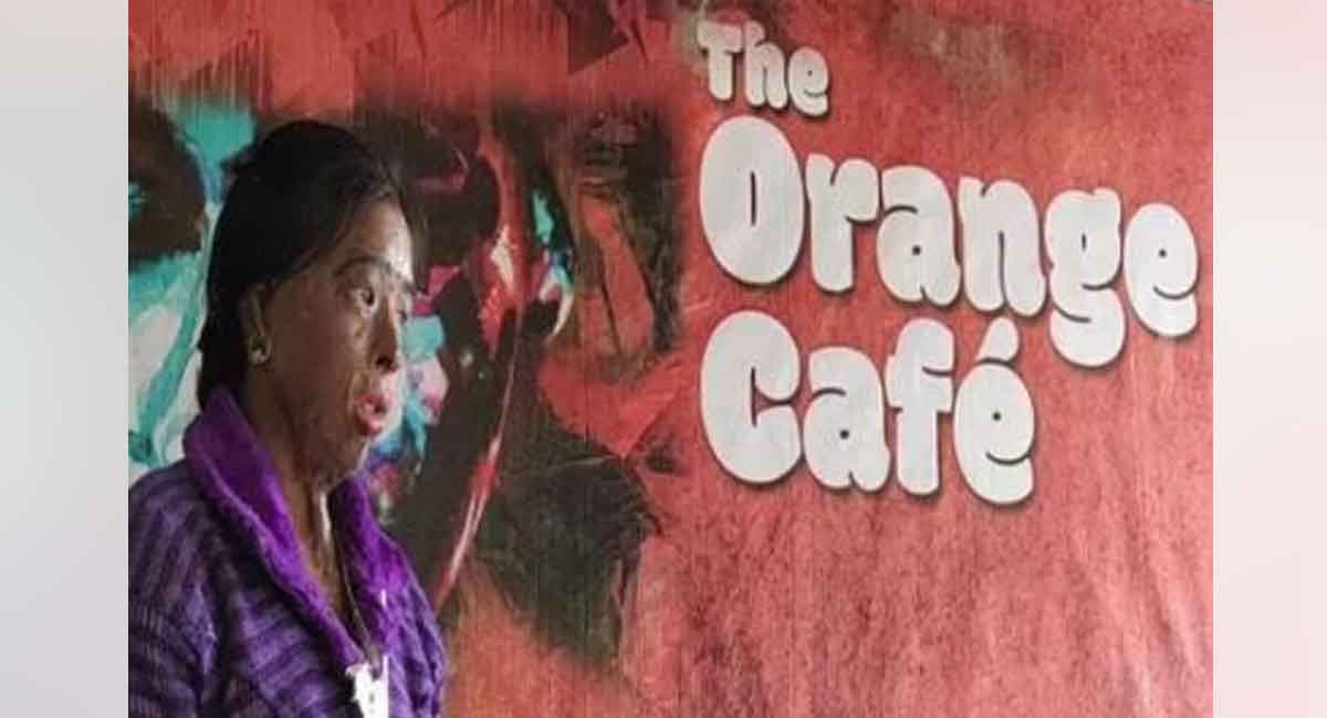 Hope rekindles for acid attack victims, ‘Sheroes’ begins work again