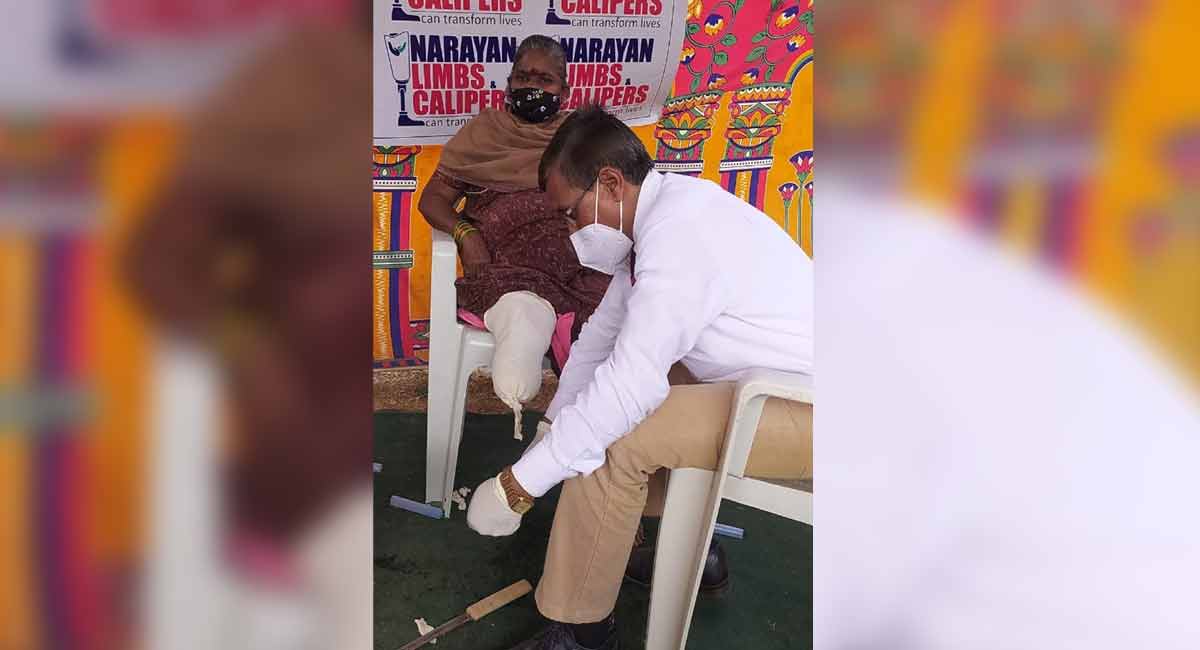 Hyderabad: Free artificial limb camp organised by Narayan Seva Sansthan