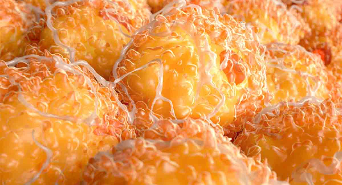 Research finds how fat cells in skin help fight acne