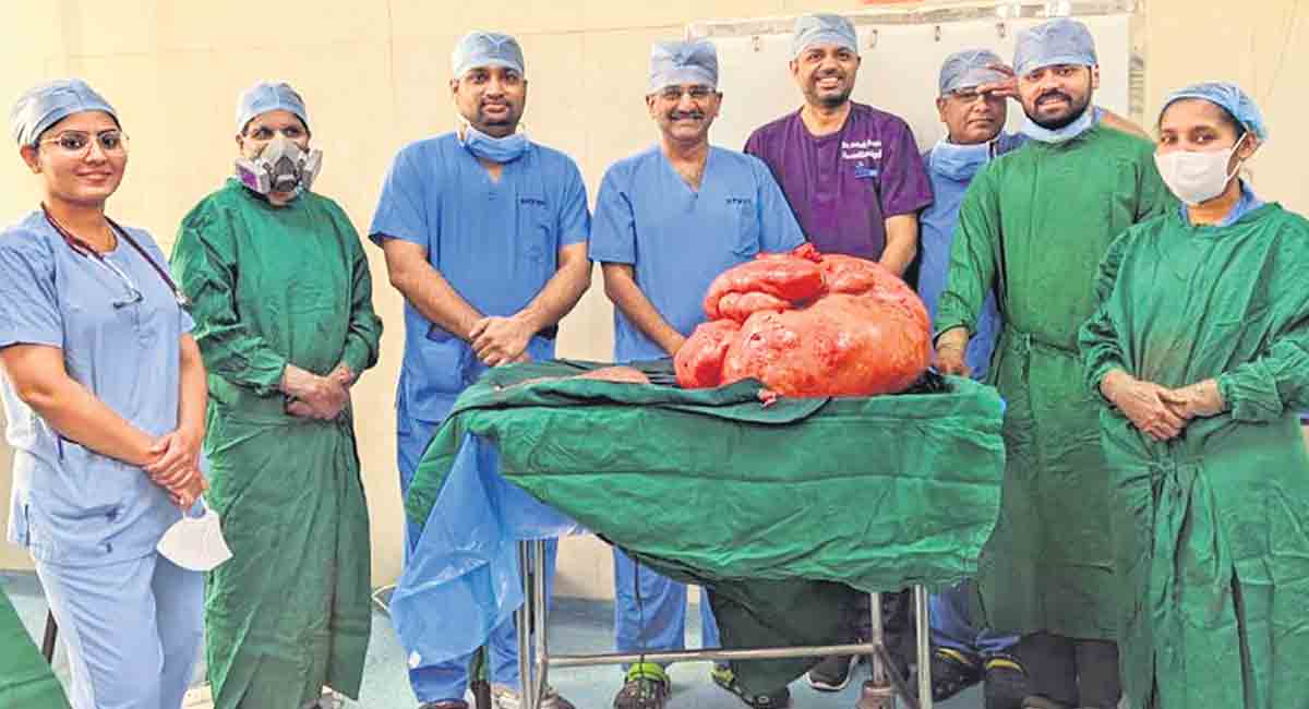 Apollo Hospital doctors remove 47 kg tumour
